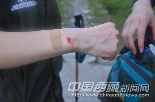 行进过程中，队员遭到了蚂蟥的侵袭。